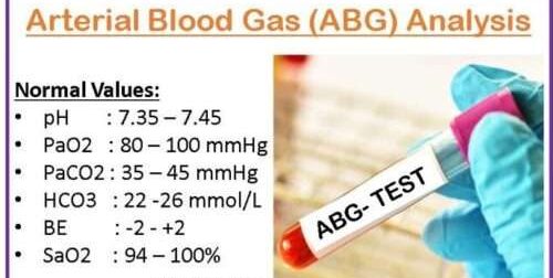 تحليل غازات الدم الشرياني 