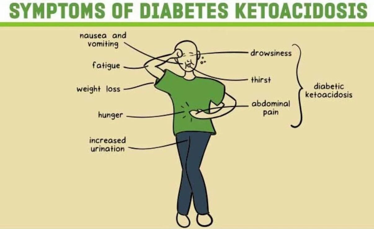 أعراض الحماض الكيتوني السكري