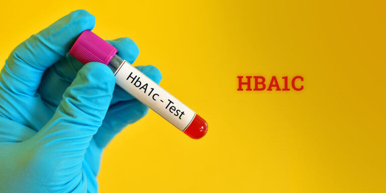 فحص سكر الدم التراكمي HbA1c