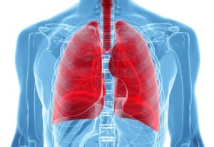 Pulmonary HTN