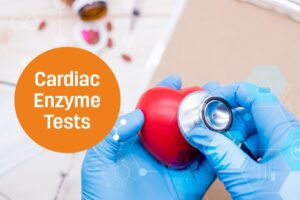 Cardiac enzymes test