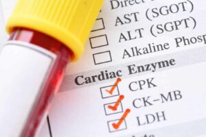 Cardiac Enzyme Testing