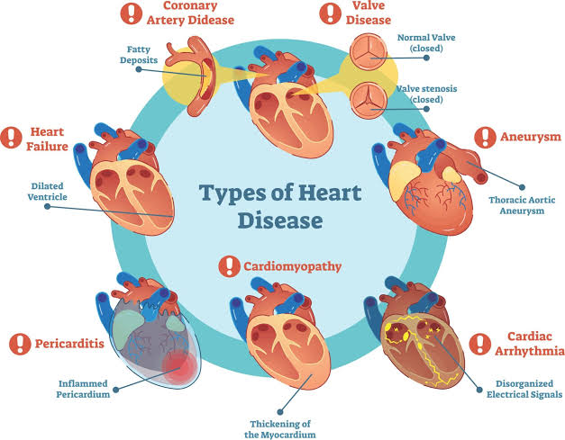 أمراض القلب 