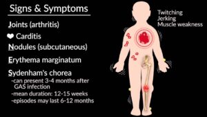 Symptoms of Rheumatic fever