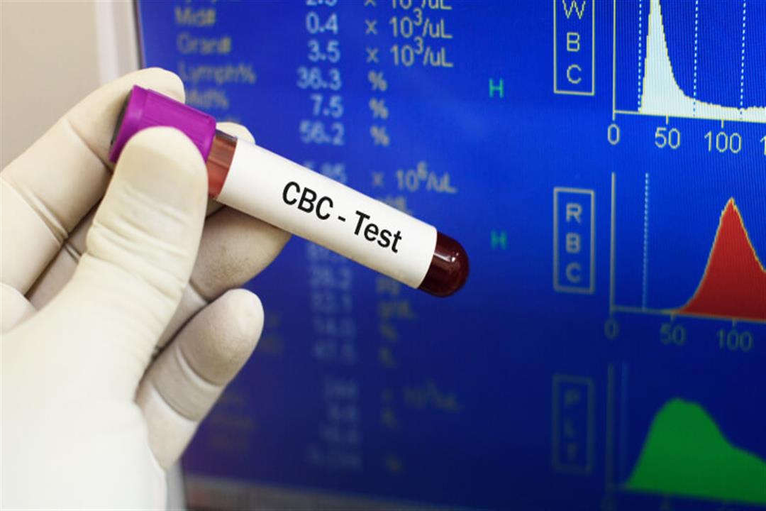 صورة الدم الكاملة - Complete Blood Count (CBC)