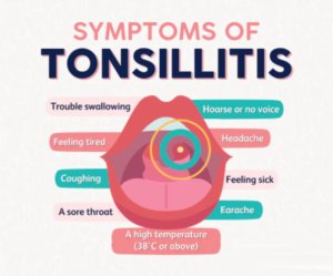 أعراض التهاب اللوزتين