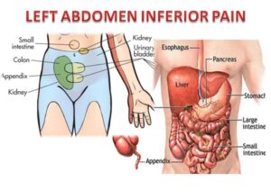 الأسباب المحتملة لألم في الجانب الأيسر من البطن فوق عظمة الحوض