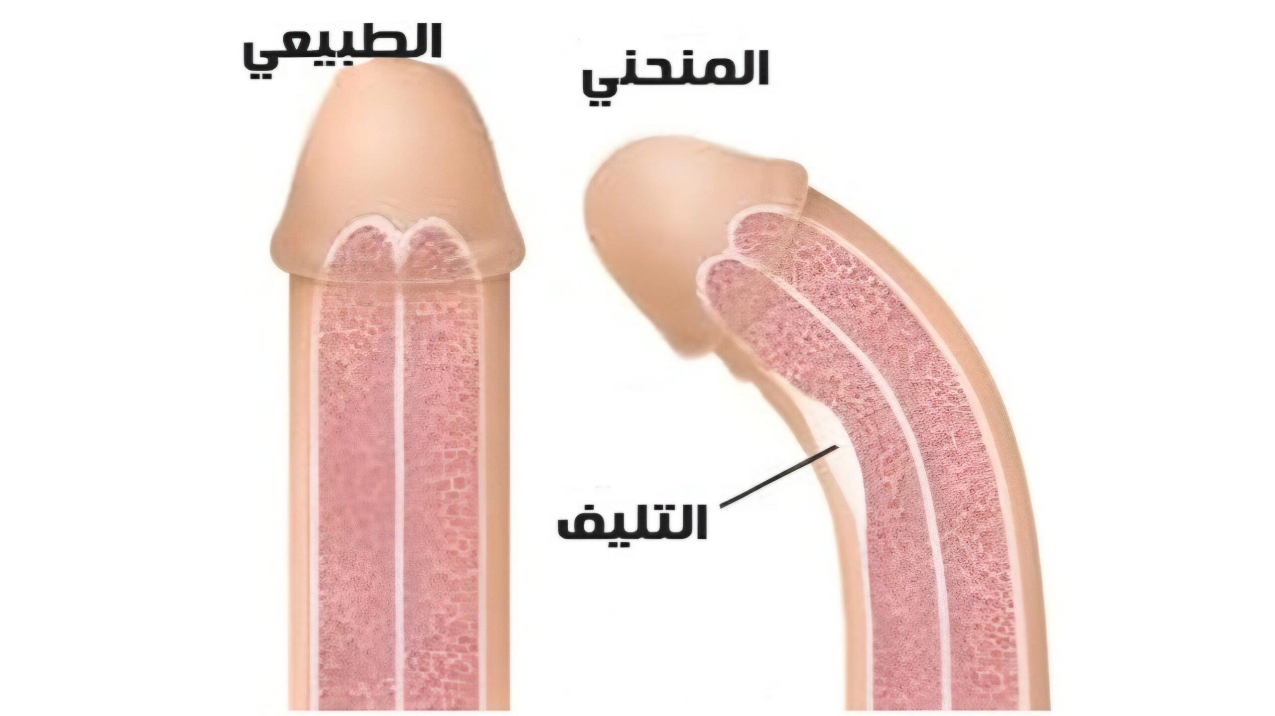 انحناء الذكر 