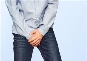 التهاب الحشفة Balanitis