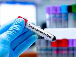 Diagnosis of testosterone deficiency