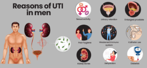 Causes of UTI in Men