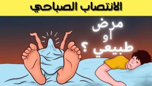 الإنتصاب في الصباح