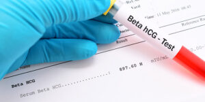 اختبار الحمل بالدم (Blood hCG Test)