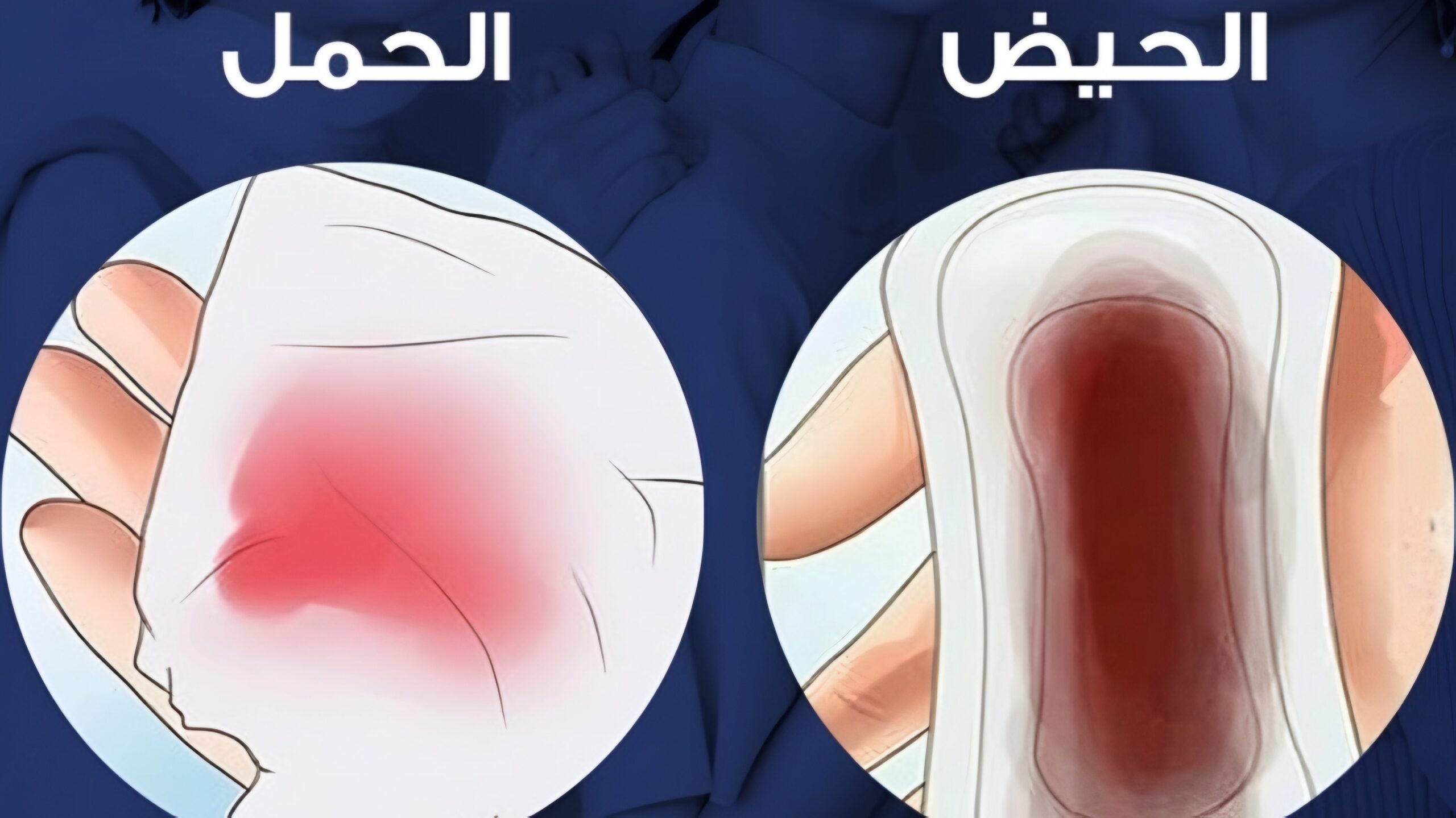 الفرق بين أعراض انغراس البويضة وأعراض الدورة الشهرية