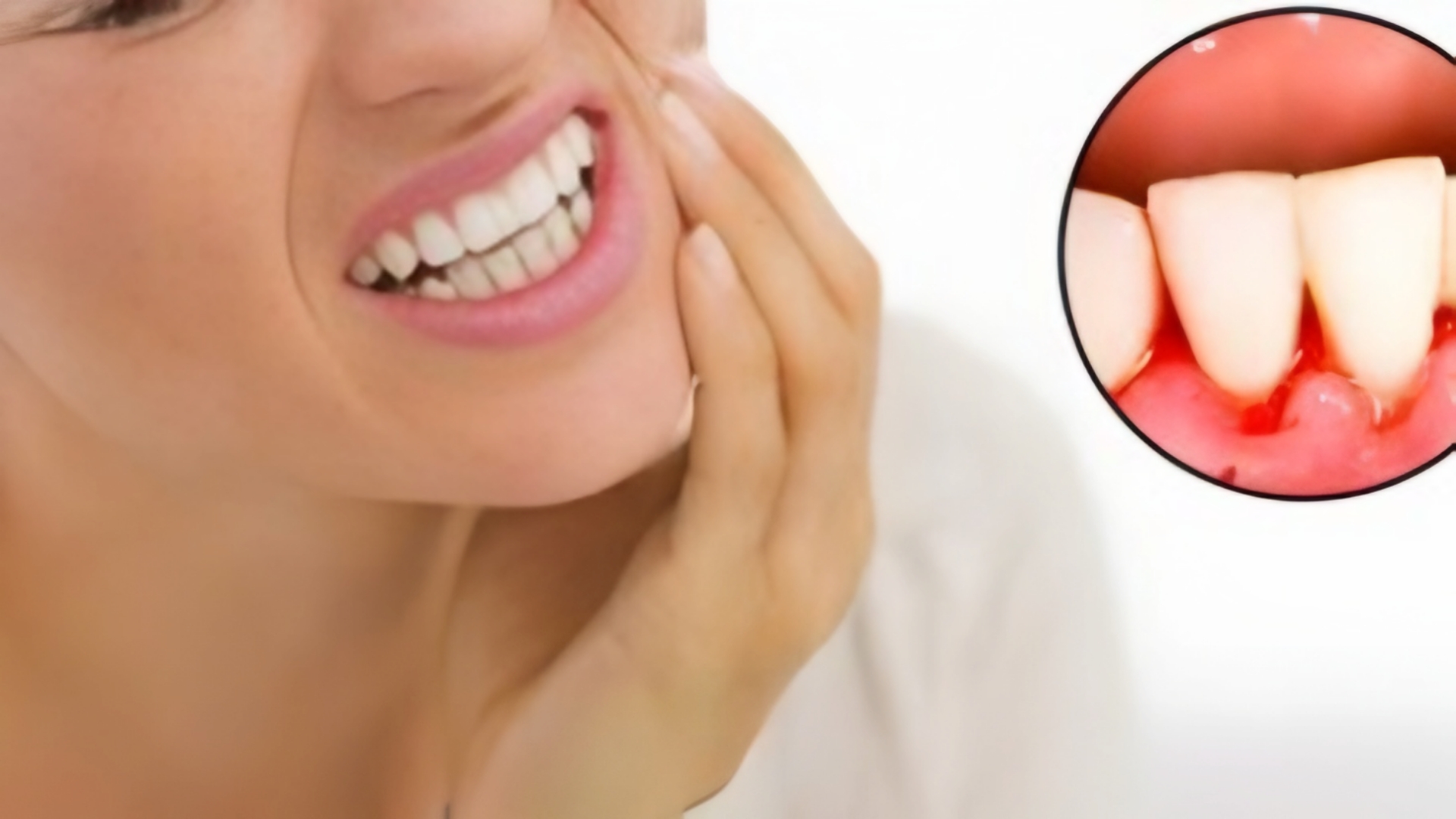 علاج التهاب اللثة سريع المفعول في المنزل