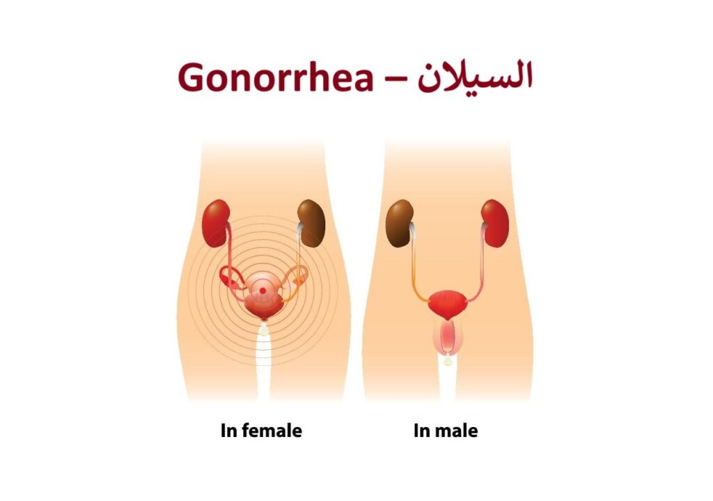 السيلان
