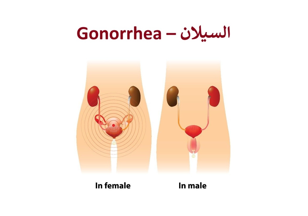 السيلان