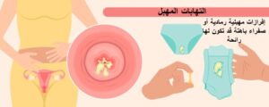 التهاب المهبل