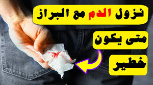 متى يكون نزول الدم مع البراز خطير