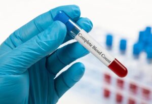 قراءة تحليل الدم - CBC (Complete Blood Count)