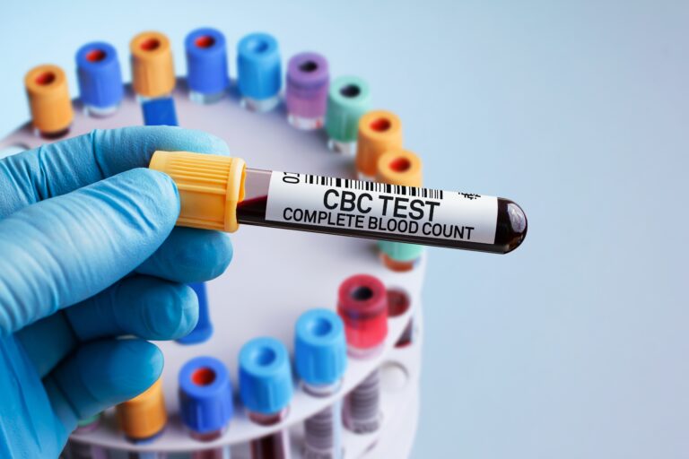 قراءة تحليل الدم - CBC (Complete Blood Count)