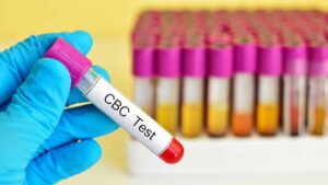 قراءة تحليل الدم - CBC (Complete Blood Count)