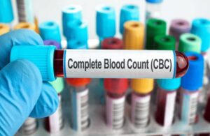 قراءة تحليل الدم - CBC (Complete Blood Count)