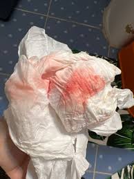 https://www.verywellhealth.com/postcoital-bleeding-3947657