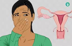 أفضل دواء لعلاج رائحة المهبل الكريهة